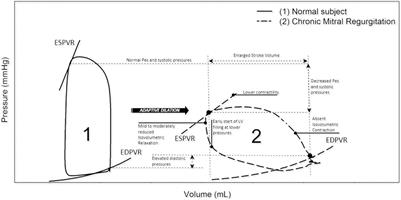 Left Ventricular Remodeling in Non-syndromic Mitral Valve Prolapse: Volume Overload or Concomitant Cardiomyopathy?